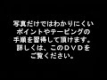 変形性膝関節症の調整法(1)