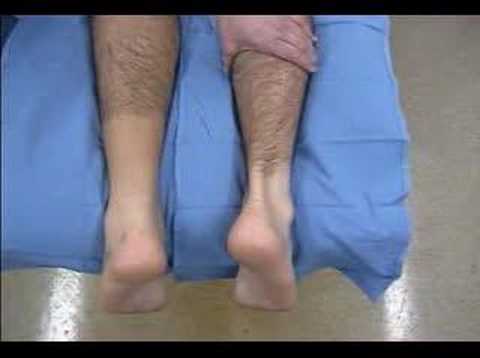 Achilles+tendonitis+surgery