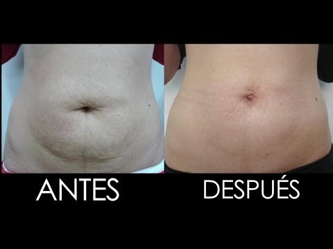 Si llaman con la eccema