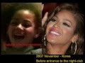 Beyonce Plastic Surgery - The Truth 5 - Youtube