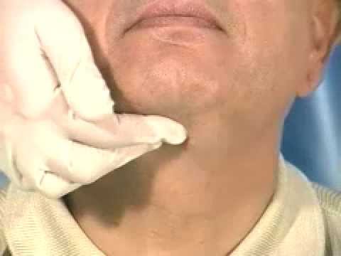 Diagnosis & Examination of the submental lymphnodes (Dentistry) - YouTube