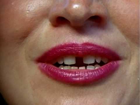 gapped teeth women