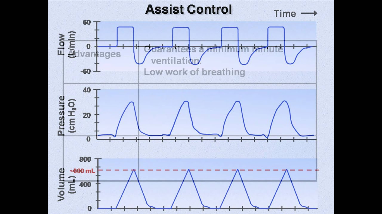 pip in mechanical ventilation