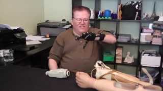 A $50 3D-Printed Prosthesis Compared to a $42,000 Myoelectric Prosthesis