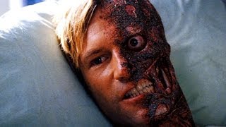 Top 10 Disfigured Movie Characters