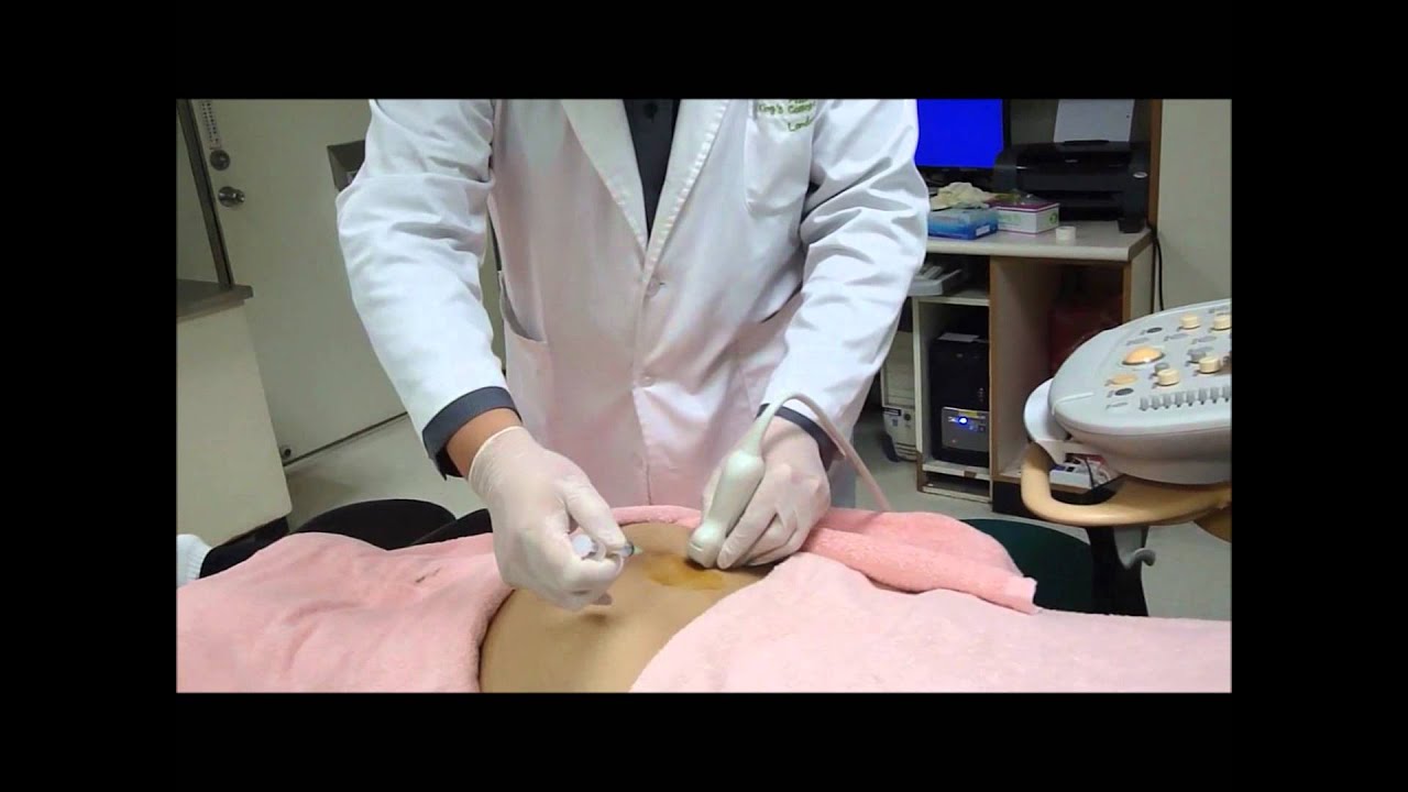 Ultrasound-Guided Sacroiliac Joint Injection.wmv - YouTube