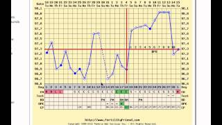 Fertility Charting With Shift Work, Inconsistent Wking Time, Short Luteal  Phase 