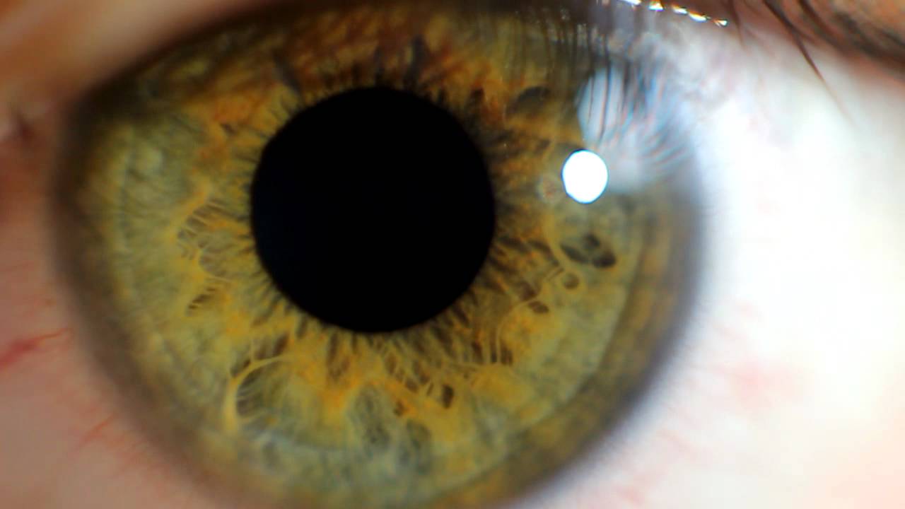 split pupil in eye