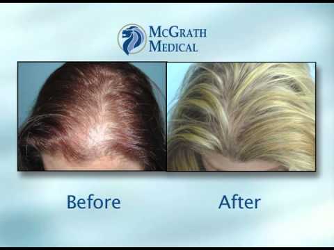 McGrath Medical | Dr. Dan McGrath | Hair Transplant Surgeon | Austin, TX