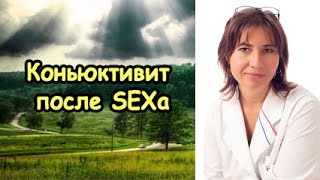 Конъюнктивит после полового акта. Екатерина Макарова