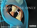 Hip Surgery