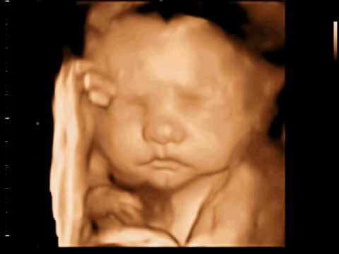 3D Ultrasound: Youtube 3d Ultrasound 28 Weeks