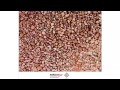 RenoFloor Frankfurt - Do it yourself Terrassensanierung | Balkonsanierung