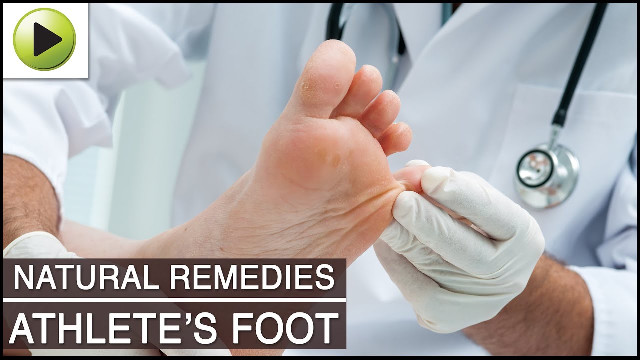 Skin Care Athlete's Foot Natural Ayurvedic Home Remedies YouTube