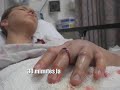 Snake Bite - caught on camera!!!