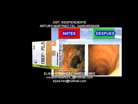 Tus perder peso corriendo importante complementar dieta perder peso corriendo