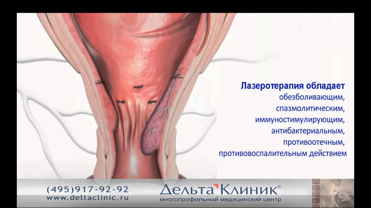 Первый месяц жизни новорожденного ребенка - особенности 90 Первый месяц жизни новорожденного ребенка - особенности 22