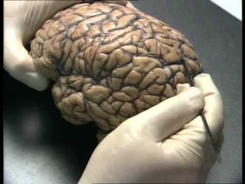 The Human Brain Anatomy - YouTube
