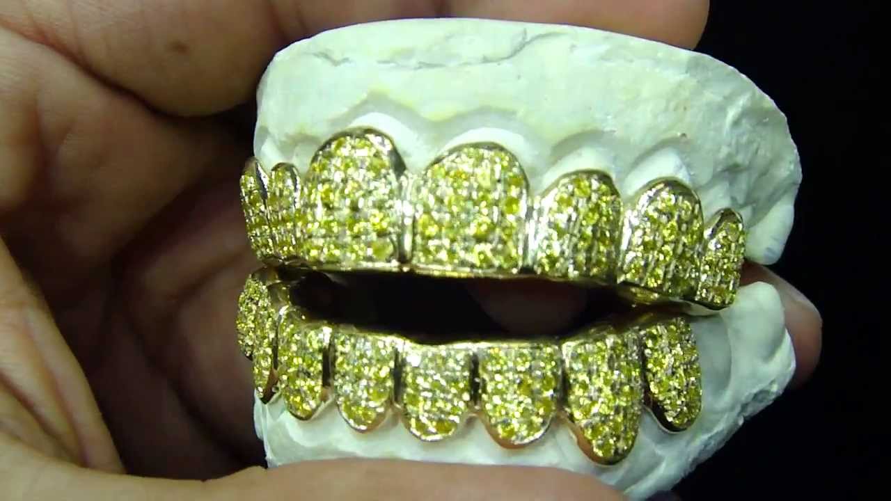 Custom Iced out Diamond Grillz Real Gold By Mr Chris Da Jeweler YouTube