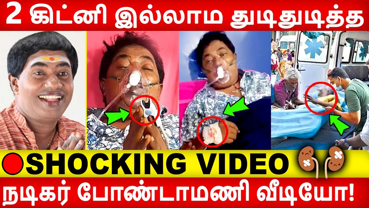 🔴 VIDEO: 2 கிட்னி இல்லாம நடிகர் போண்டாமணி கண்ணீர்  வீடியோ! Bondamani | Kidney