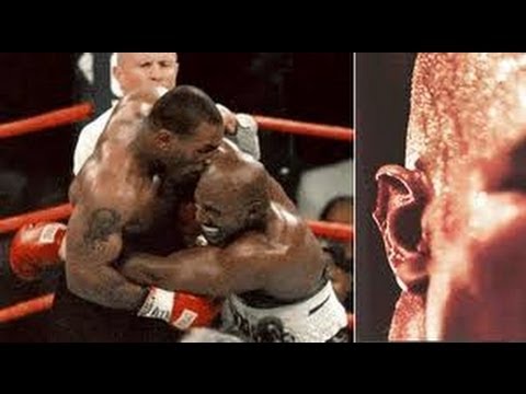 Sport Science - Mike Tyson Ear Bite | Furious Pete - YouTube