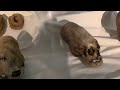 Real Elongated Skulls In The Ica Museum In Peru