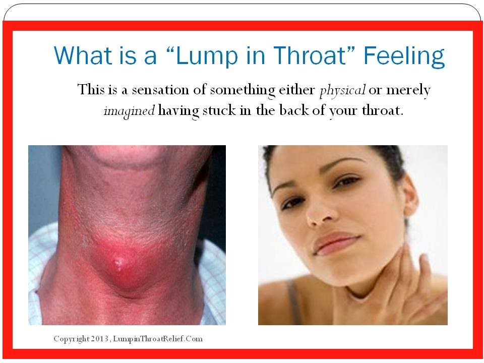 Lump In Throat Globus 16
