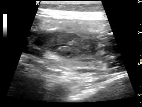 puppy ultrasound ultrasound puppy ultrasound ultrasound