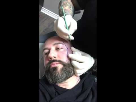 Facial Scarification Part 1