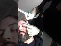 Facial Scarification Part 1