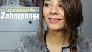 ZAHNSPANGE | Behandlung, Freund, Freunde, eure Fragen