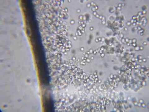 Baker's Yeast At Work 1000X Magnification (Microscopy) - YouTube