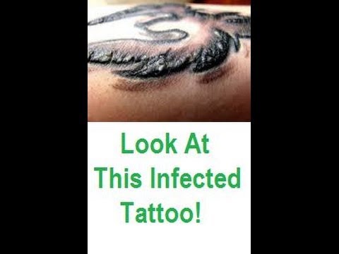 Ointment For Tattoo Infection | ointments Ointment For Tattoo Infection | ointments