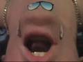 Chins