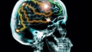 Мозг и здоровье