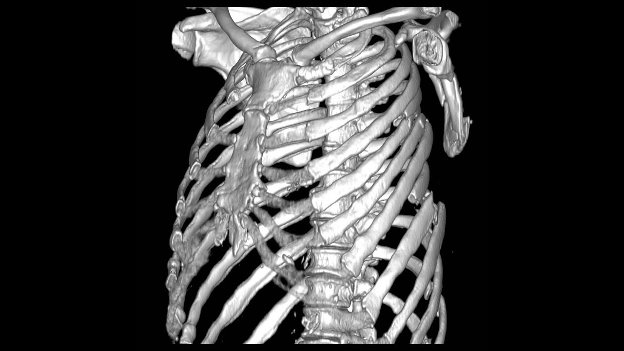 Ребра со спины фото (много фото!) - piczoom.ru