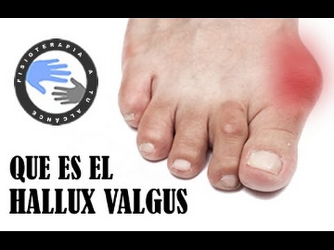 Las bañeras medicinales para los pies al hongo