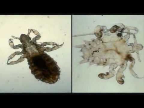 How Long Diatomaceous Earth To Kill Bed Bugs How Long Diatomaceous Earth To Kill Bed Bugs