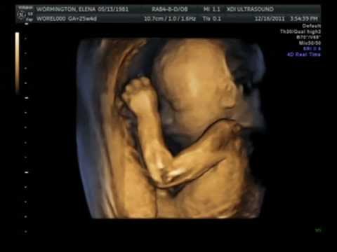 30 weeks pregnant 4d ultrasound