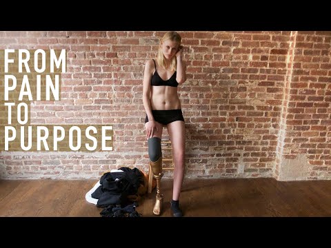 Download Lauren Wasser: How One Model Lost Her Leg to Toxic Shock Syndrome and Found her Life’s Purpose