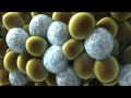 Video: CoolSculpting® at Young Medical Spa® in Pennsylvania