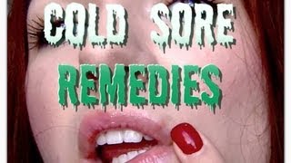 UPDATED Cold Sore Routine: Treatment for cold sores (fever blisters)