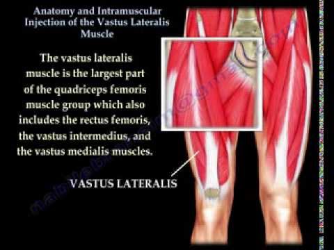 Vastus Lateralis intramuscular Injection - Everything You Need To Know