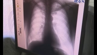 Фотографируйтесь на здоровье! По Искитимскому району колесит машина ФЛГ