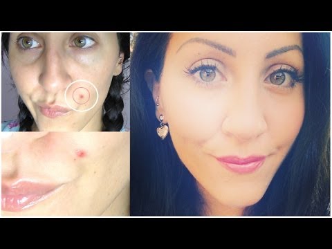 La crema non costosa da pigmentary nota su