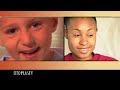 Video: Otoplasty - The Refine Institute