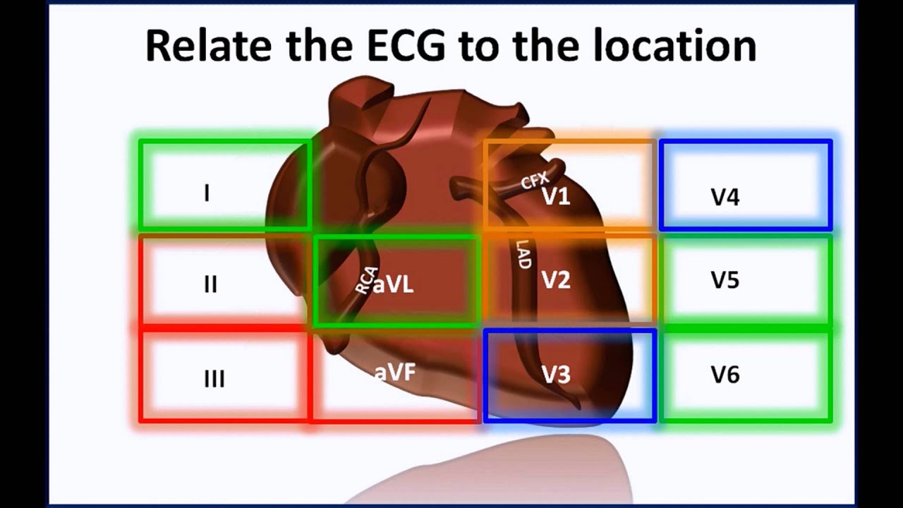 HELP PANCE PANRE ECG MAP understanding 12 lead locations - YouTube