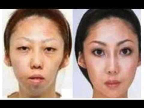 BBC News - The dark side of cosmetic surgery in Thailand