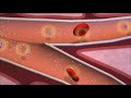 Insulin and the Regulation of Glucose in the Blood