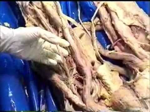 Gross Anatomy: hamstring muscles; popliteal fossa - YouTube